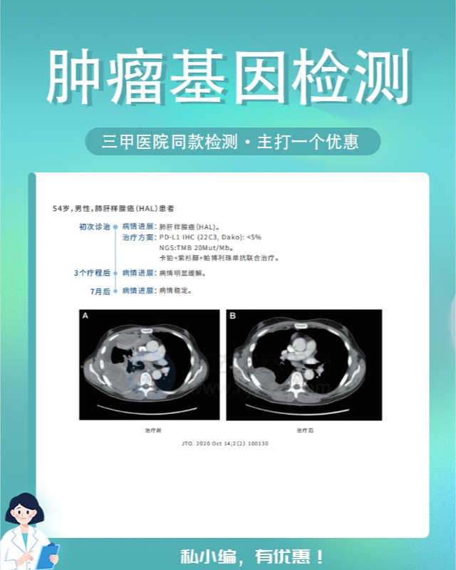 上海哪家医院可以做肿瘤基因检测去哪里实验
